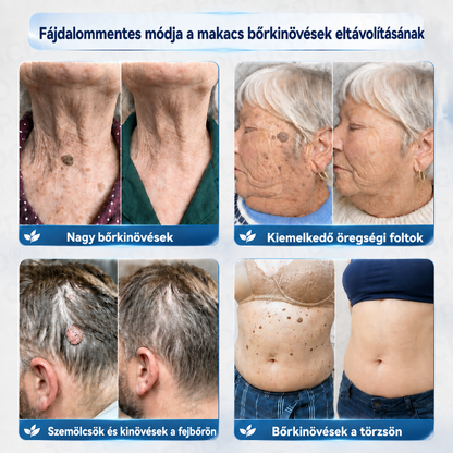 PuraCure® 𝟕 𝐍𝐚𝐩𝐨𝐬 𝐊𝐫é𝐦 𝐁ő𝐫𝐟ü𝐠𝐠𝐞𝐥é𝐤𝐞𝐤 é𝐬 𝐏𝐢𝐠𝐦𝐞𝐧𝐭𝐟𝐨𝐥𝐭𝐨𝐤 𝐄𝐥𝐥𝐞𝐧 (𝐅á𝐣𝐝𝐚𝐥𝐨𝐦𝐦𝐞𝐧𝐭𝐞𝐬 𝐅𝐨𝐫𝐦𝐮𝐥𝐚 – 𝐇𝐞𝐠𝐞𝐤 𝐍é𝐥𝐤ü𝐥)🍁