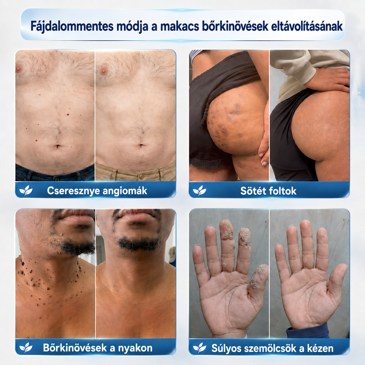 PuraCure® 𝟕 𝐍𝐚𝐩𝐨𝐬 𝐊𝐫é𝐦 𝐁ő𝐫𝐟ü𝐠𝐠𝐞𝐥é𝐤𝐞𝐤 é𝐬 𝐏𝐢𝐠𝐦𝐞𝐧𝐭𝐟𝐨𝐥𝐭𝐨𝐤 𝐄𝐥𝐥𝐞𝐧 (𝐅á𝐣𝐝𝐚𝐥𝐨𝐦𝐦𝐞𝐧𝐭𝐞𝐬 𝐅𝐨𝐫𝐦𝐮𝐥𝐚 – 𝐇𝐞𝐠𝐞𝐤 𝐍é𝐥𝐤ü𝐥)🍁
