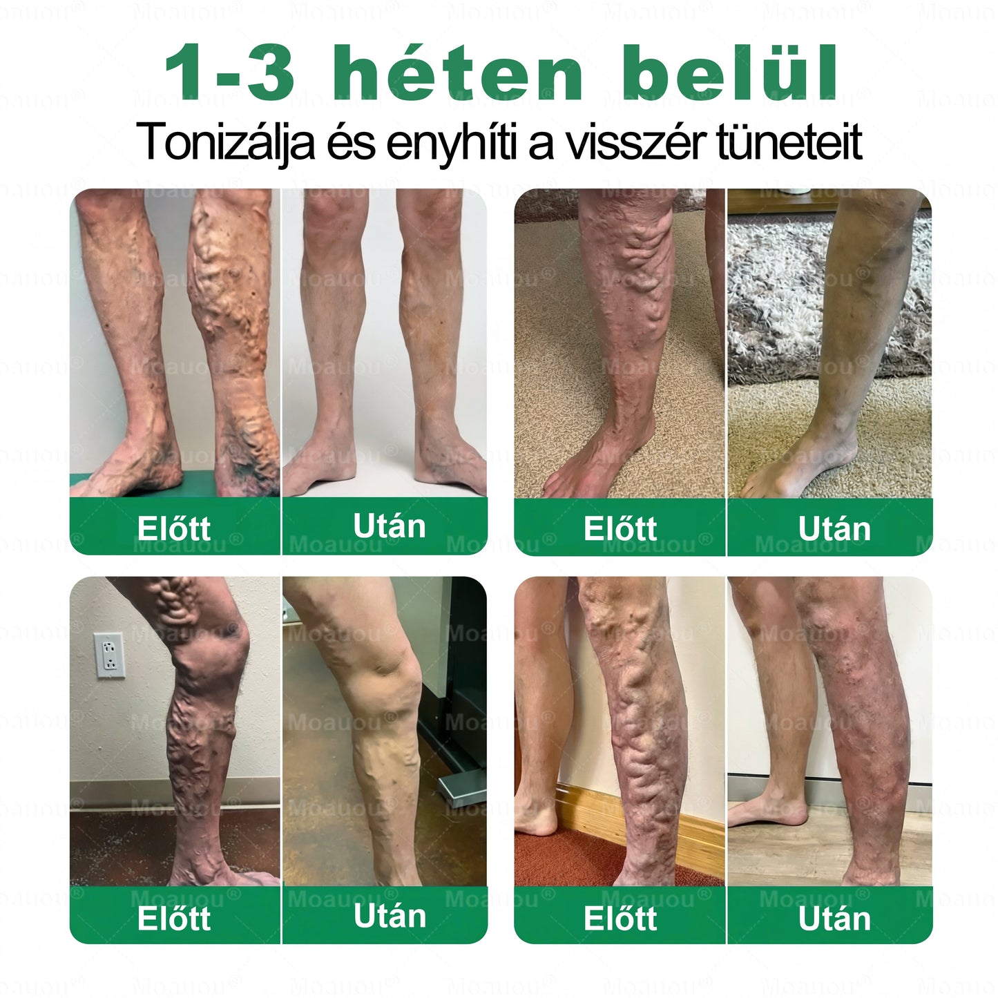 🇭🇺👨‍⚕️✅Moauou® Ércélzó Mikrotűs Tapasz ⚡ Azonnali enyhülés, hosszan tartó eredmények – NAGY AKCIÓ!