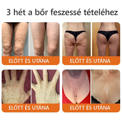 🐝 PuraCure® Méhméreg Bőr Helyreállító Krém  (👨‍⚕‍CE Tanúsítvány) 🔥 Magyar fejlesztés, magyarországi gyártás és szállítás