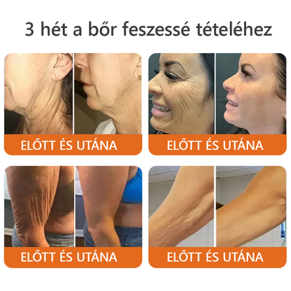 🤍 Bőrgyógyász ajánlása ✨ ZödVita® Méhméreg Bőr Helyreállító Krém 🔥 Magyar fejlesztés, magyarországi gyártás és szállítás