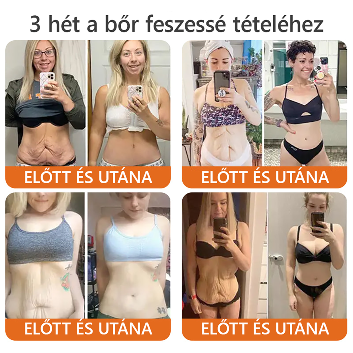 🐝 PuraCure® Méhméreg Bőr Helyreállító Krém  (👨‍⚕‍CE Tanúsítvány) 🔥 Magyar fejlesztés, magyarországi gyártás és szállítás