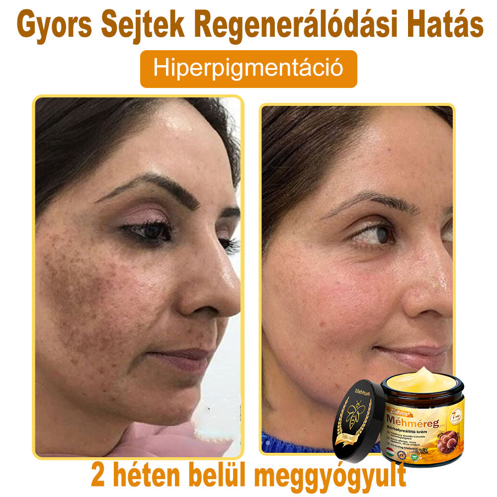 🤍 Bőrgyógyász ajánlása ✨ ZödVita® Méhméreg Bőr Helyreállító Krém 🔥 Magyar fejlesztés, magyarországi gyártás és szállítás