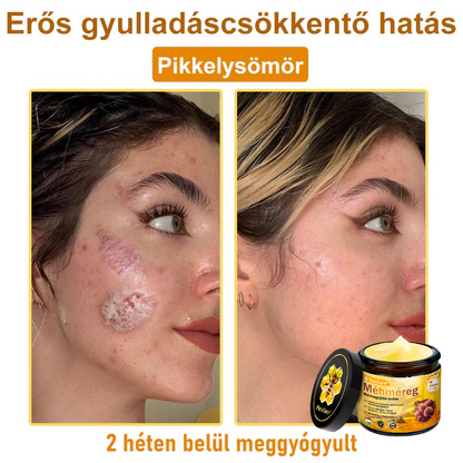 𝐏𝐮𝐫𝐚𝐂𝐮𝐫𝐞® 𝐌é𝐡𝐦é𝐫𝐞𝐠 𝐁ő𝐫 𝐇𝐞𝐥𝐲𝐫𝐞á𝐥𝐥í𝐭ó 𝐊𝐫é𝐦 (👨‍⚕‍𝐂𝐄 𝐓𝐚𝐧ú𝐬í𝐭𝐯á𝐧𝐲)👍✅