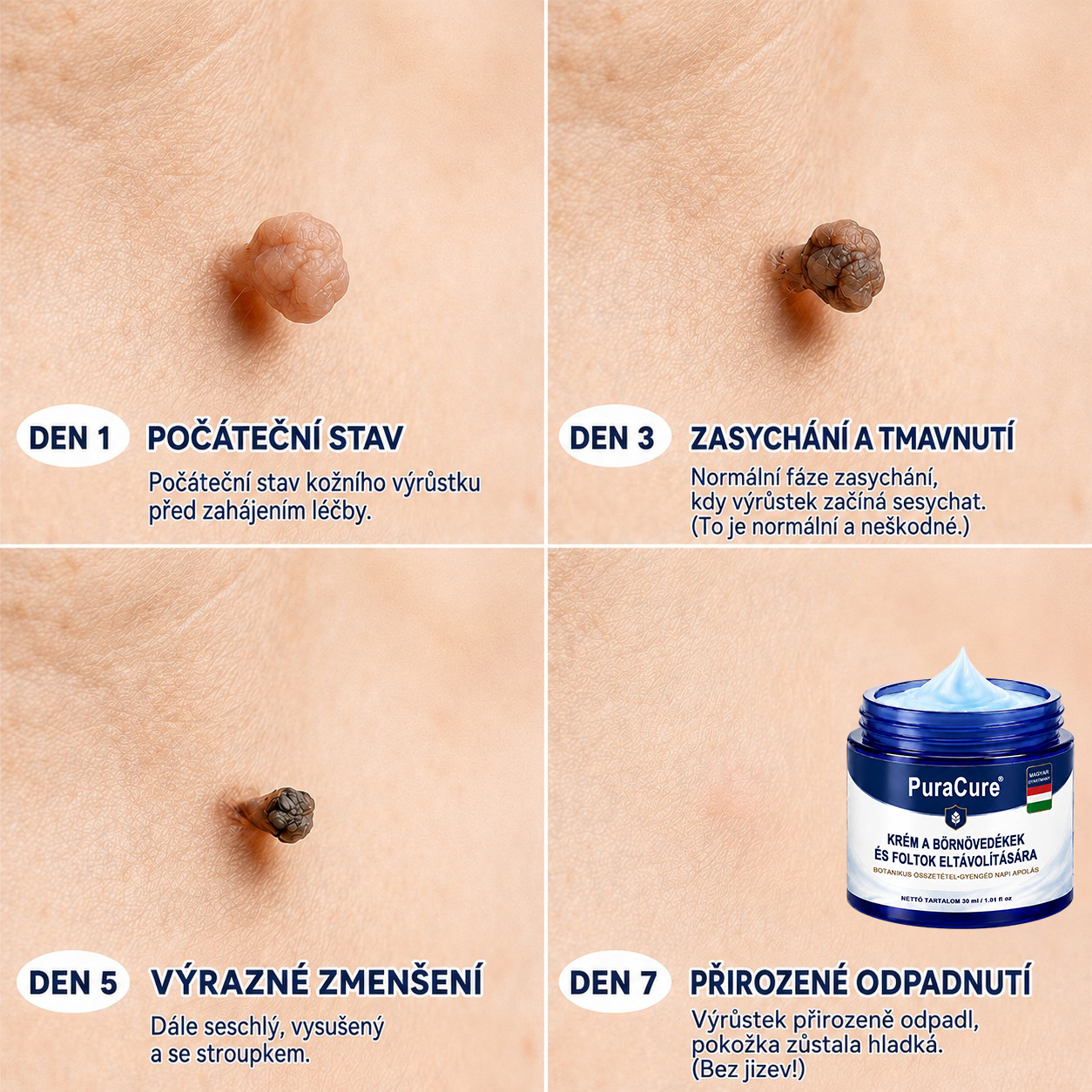 PuraCure® 𝟕 𝐍𝐚𝐩𝐨𝐬 𝐊𝐫é𝐦 𝐁ő𝐫𝐟ü𝐠𝐠𝐞𝐥é𝐤𝐞𝐤 é𝐬 𝐏𝐢𝐠𝐦𝐞𝐧𝐭𝐟𝐨𝐥𝐭𝐨𝐤 𝐄𝐥𝐥𝐞𝐧 (𝐅á𝐣𝐝𝐚𝐥𝐨𝐦𝐦𝐞𝐧𝐭𝐞𝐬 𝐅𝐨𝐫𝐦𝐮𝐥𝐚 – 𝐇𝐞𝐠𝐞𝐤 𝐍é𝐥𝐤ü𝐥)🍁