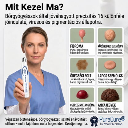 PuraCure® 𝟕 𝐍𝐚𝐩𝐨𝐬 Bőrkinövés- és Folteltávolító Toll Fájdalommentes és Hegmentes Professzionális Rollerball