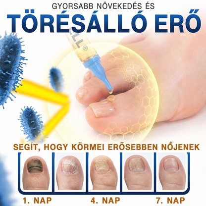 🩹🇭🇺 BSWELL® Gomba‑mentes méhméreg körömkezelés 💅🦶