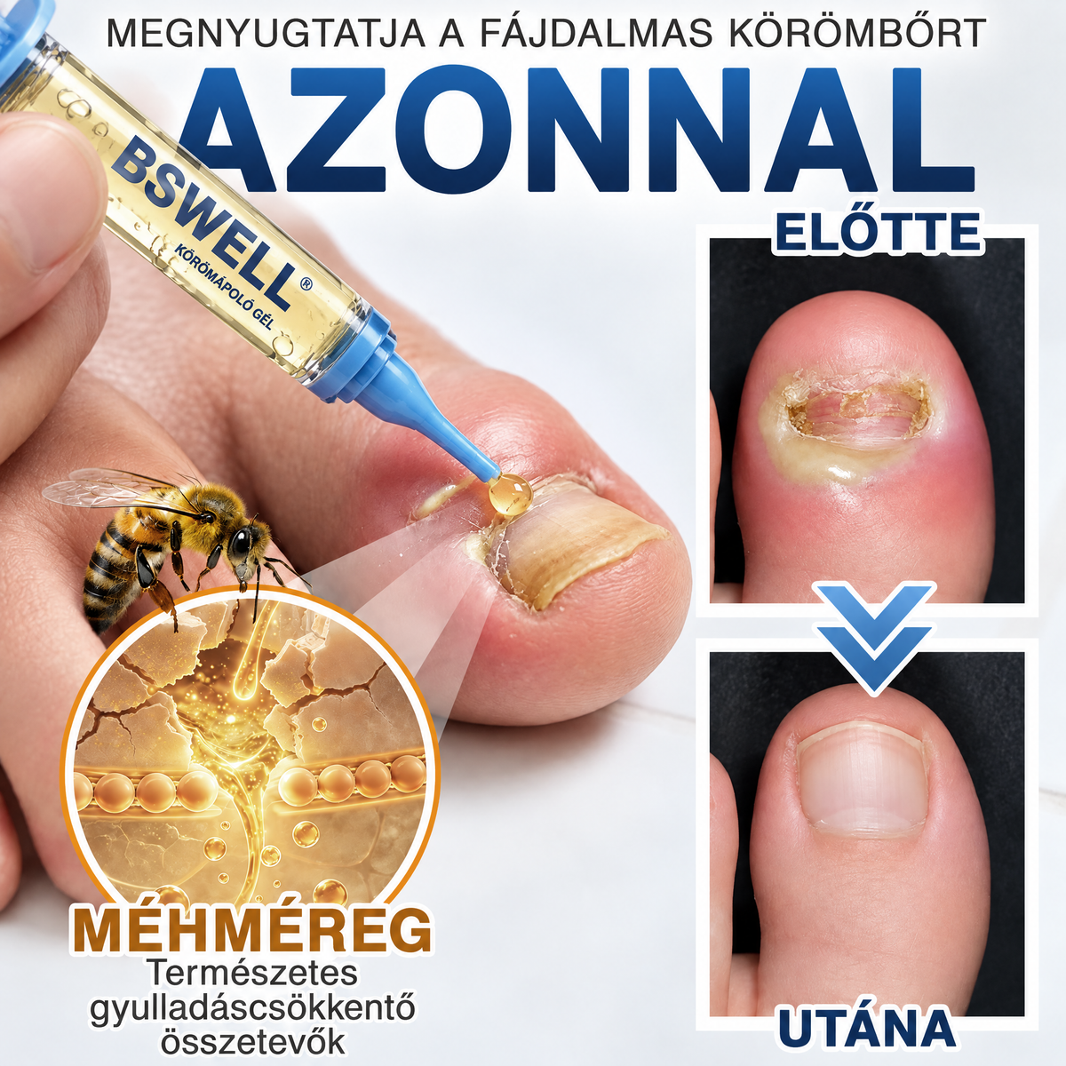 🩹🇭🇺 BSWELL® Gomba‑mentes méhméreg körömkezelés 💅🦶