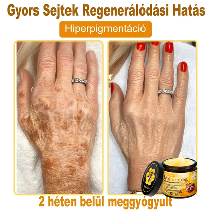 🏆𝐏𝐮𝐫𝐚𝐂𝐮𝐫𝐞® 𝐌é𝐡𝐦é𝐫𝐞𝐠 𝐁ő𝐫 𝐇𝐞𝐥𝐲𝐫𝐞á𝐥𝐥í𝐭ó 𝐊𝐫é𝐦 (👨‍⚕‍𝐂𝐄 𝐓𝐚𝐧ú𝐬í𝐭𝐯á𝐧𝐲)👍✅