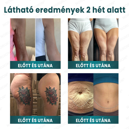 ✨ NORUION® Q10 x Növényi Nano Exoszóma Haladó Ránctalanító Krém