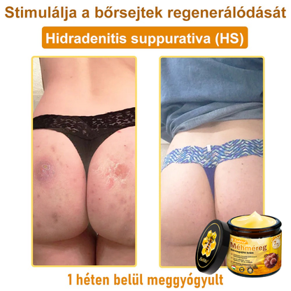 ZödVita® 💥 Méhméreg Bőr Helyreállító Krém 🔥 Magyar fejlesztés, magyarországi gyártás és szállítás
