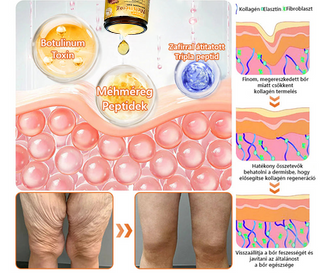 𝐏𝐮𝐫𝐚𝐂𝐮𝐫𝐞® 𝐌é𝐡𝐦é𝐫𝐞𝐠 𝐁ő𝐫 𝐇𝐞𝐥𝐲𝐫𝐞á𝐥𝐥í𝐭ó 𝐊𝐫é𝐦 (👨‍⚕‍𝐂𝐄 𝐓𝐚𝐧ú𝐬í𝐭𝐯á𝐧𝐲)👍✅