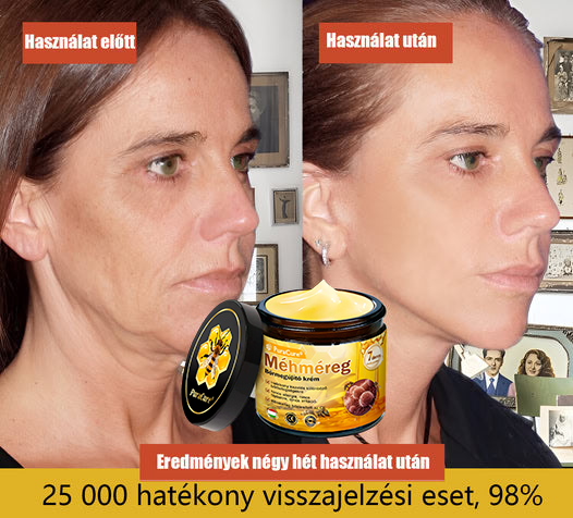 🐝 PuraCure® Méhméreg Bőr Helyreállító Krém  (👨‍⚕‍CE Tanúsítvány) 🔥 Magyar fejlesztés, magyarországi gyártás és szállítás