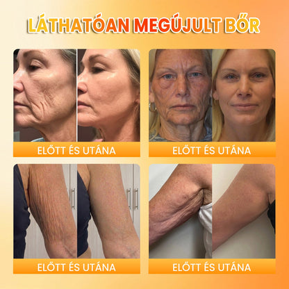 PuraCure® MÉHMÉREG Bőrmegújító krém