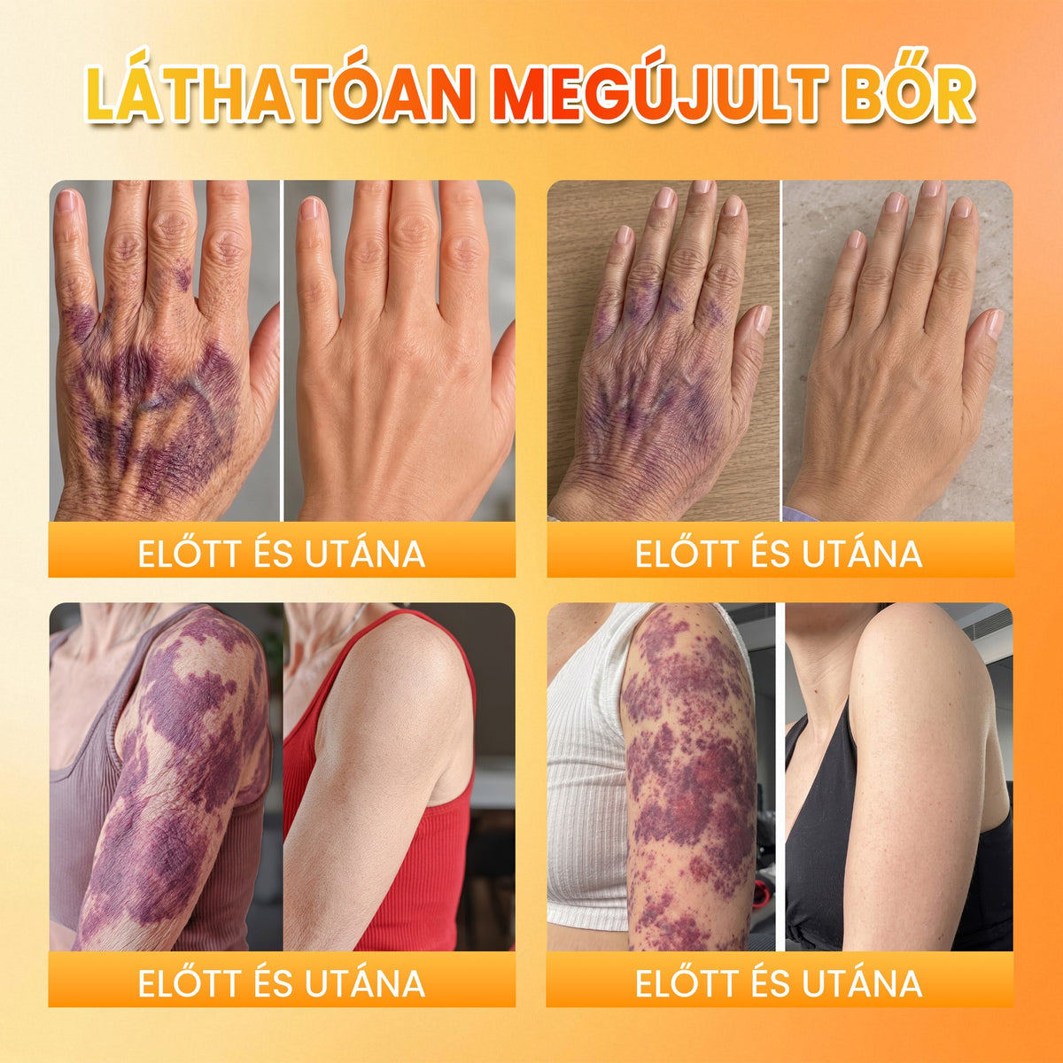 PuraCure® MÉHMÉREG Bőrmegújító krém