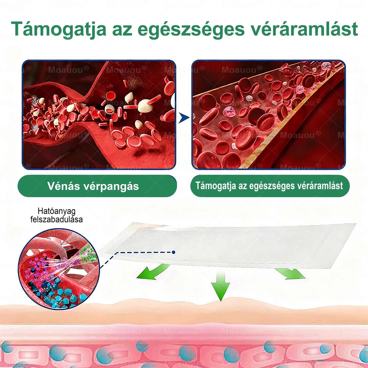 🇭🇺👨‍⚕️✅Moauou® Ércélzó Mikrotűs Tapasz ⚡ Azonnali enyhülés, hosszan tartó eredmények – NAGY AKCIÓ!