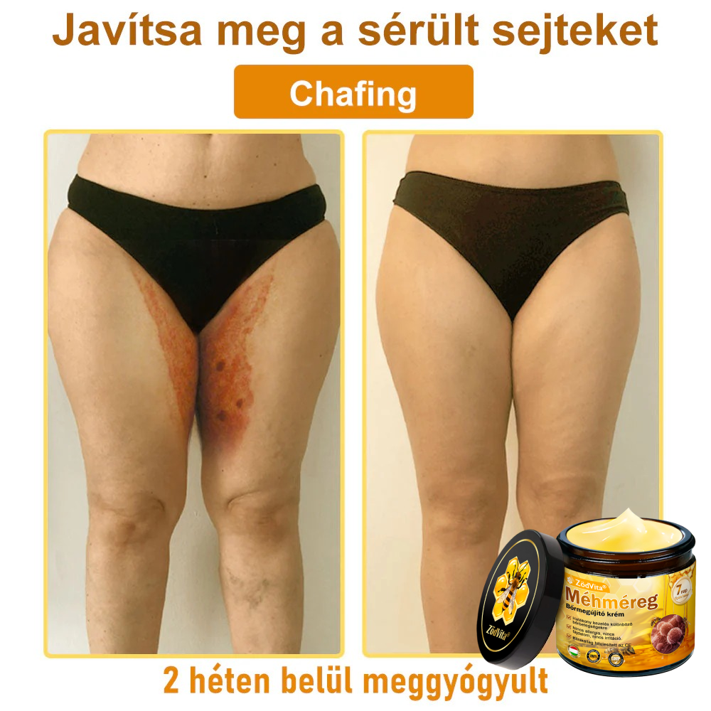 ZödVita® 💥 Méhméreg Bőr Helyreállító Krém 🔥 Magyar fejlesztés, magyarországi gyártás és szállítás