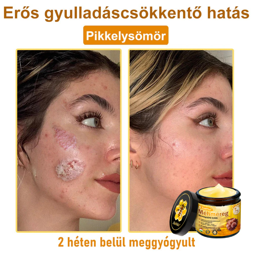 ZödVita® 💥 Méhméreg Bőr Helyreállító Krém 🔥 Magyar fejlesztés, magyarországi gyártás és szállítás