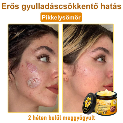 ZödVita® 💥 Méhméreg Bőr Helyreállító Krém 🔥 Magyar fejlesztés, magyarországi gyártás és szállítás