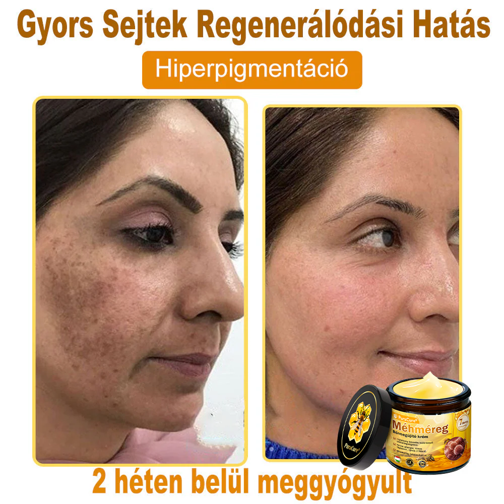 𝐏𝐮𝐫𝐚𝐂𝐮𝐫𝐞® 𝐌é𝐡𝐦é𝐫𝐞𝐠 𝐁ő𝐫 𝐇𝐞𝐥𝐲𝐫𝐞á𝐥𝐥í𝐭ó 𝐊𝐫é𝐦 (👨‍⚕‍𝐂𝐄 𝐓𝐚𝐧ú𝐬í𝐭𝐯á𝐧𝐲)👍✅