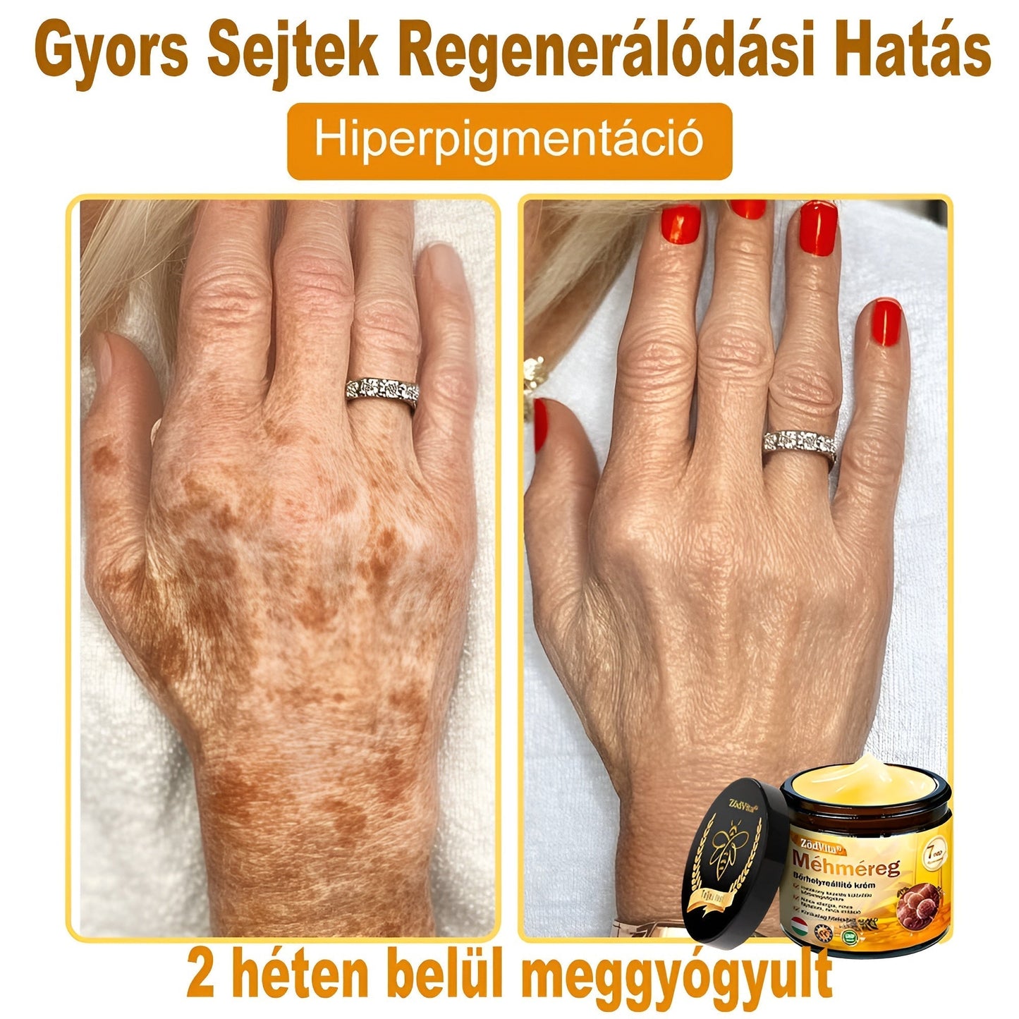 🤍 Bőrgyógyász ajánlása ✨ ZödVita® Méhméreg Bőr Helyreállító Krém 🔥 Magyar fejlesztés, magyarországi gyártás és szállítás