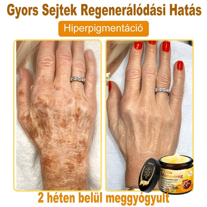 🤍 Bőrgyógyász ajánlása ✨ ZödVita® Méhméreg Bőr Helyreállító Krém 🔥 Magyar fejlesztés, magyarországi gyártás és szállítás
