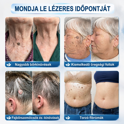 PuraCure® 𝟕 𝐍𝐚𝐩𝐨𝐬 Bőrkinövés- és Folteltávolító Toll Fájdalommentes és Hegmentes Professzionális Rollerball