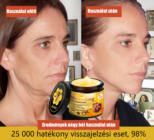 🤍 Bőrgyógyász ajánlása ✨ ZödVita® Méhméreg Bőr Helyreállító Krém 🔥 Magyar fejlesztés, magyarországi gyártás és szállítás