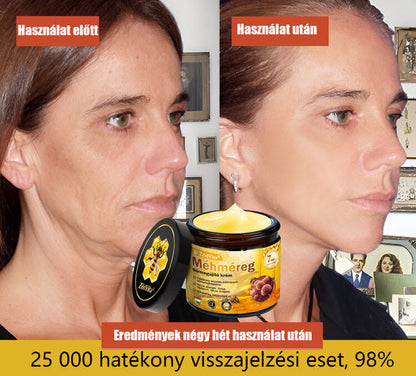 🤍 Bőrgyógyász ajánlása ✨ ZödVita® Méhméreg Bőr Helyreállító Krém 🔥 Magyar fejlesztés, magyarországi gyártás és szállítás