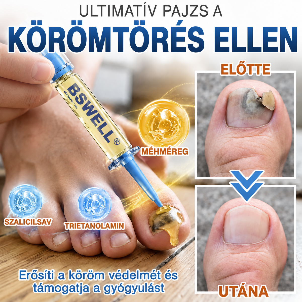 🩹🇭🇺 BSWELL® Gomba‑mentes méhméreg körömkezelés 💅🦶