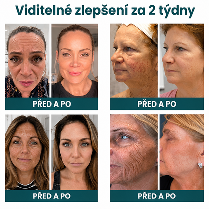 🔥 NORUION® Q10 x Rostlinné nano exosomy – Pokročilý krém proti vráskám