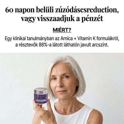 👉100K+ ELADVA  – 🔥✨PuraCure® Zúzódásjavító és bőrerősítő krém (𝐂𝐄 𝐓𝐚𝐧ú𝐬í𝐭𝐯á𝐧𝐲)👍✅