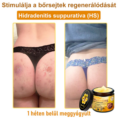 𝐏𝐮𝐫𝐚𝐂𝐮𝐫𝐞® 𝐌é𝐡𝐦é𝐫𝐞𝐠 𝐁ő𝐫 𝐇𝐞𝐥𝐲𝐫𝐞á𝐥𝐥í𝐭ó 𝐊𝐫é𝐦 (👨‍⚕‍𝐂𝐄 𝐓𝐚𝐧ú𝐬í𝐭𝐯á𝐧𝐲)👍✅