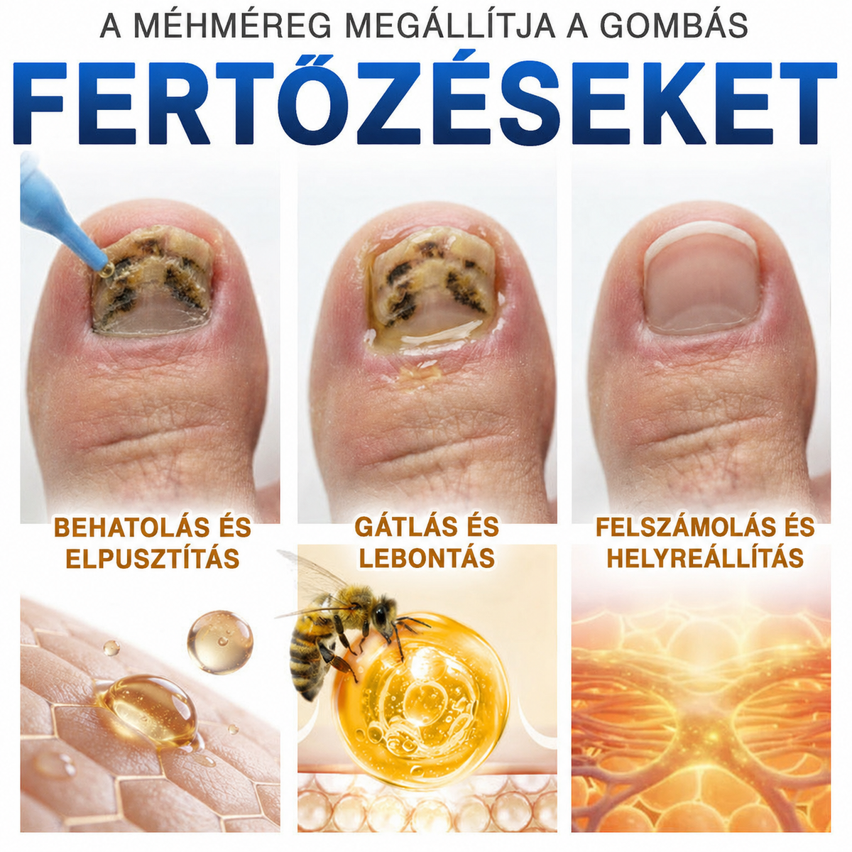 🩹🇭🇺 BSWELL® Gomba‑mentes méhméreg körömkezelés 💅🦶