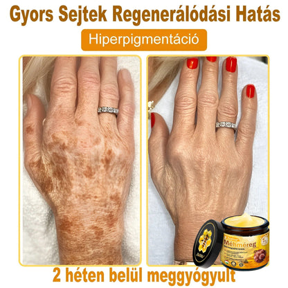 ZödVita® 💥 Méhméreg Bőr Helyreállító Krém 🔥 Magyar fejlesztés, magyarországi gyártás és szállítás